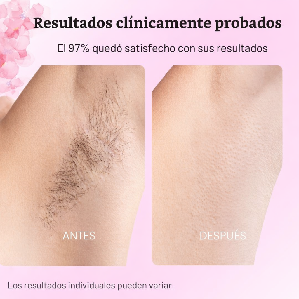 Sistema Botánico de Control del Vello: Cyperus Rotundus Oil 30 mL