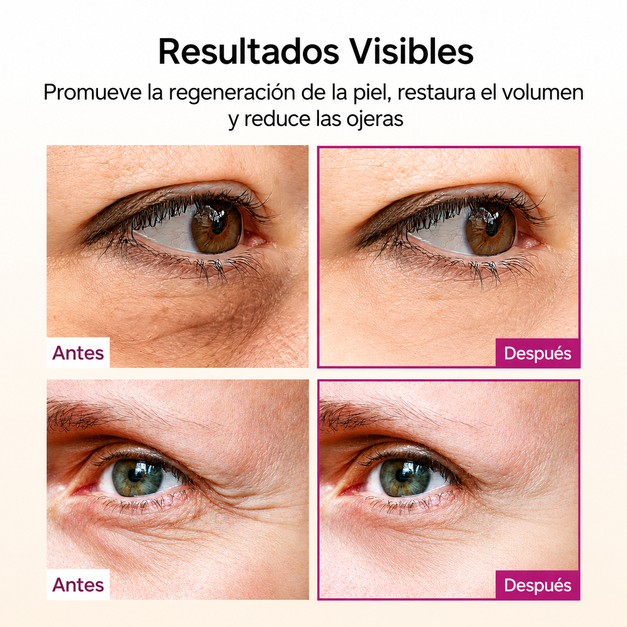 Tratamiento Dermocorrector ProElasticidad: Complejo Regenerador Dr Melaxin Cemenrete
